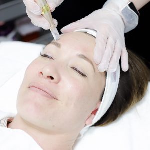 Microdermabrasion Treatment 